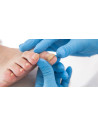 Remède naturel pour les mycoses de l'ongle et du pied