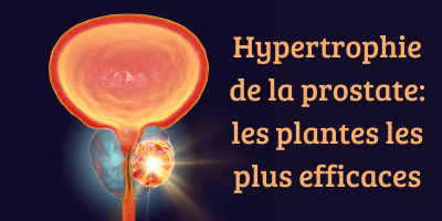 Hypertrophie bénigne de la prostate: les plantes les plus efficaces.